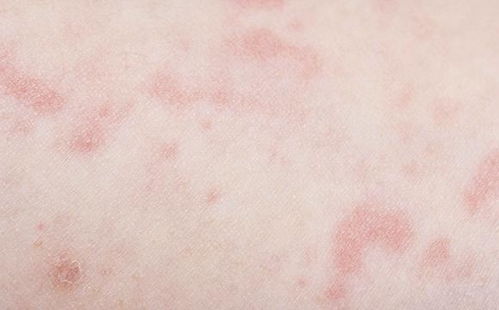 ������ݡ�����ʲôҩ