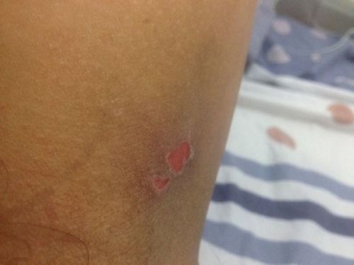 ��Ұ����ɳ_��Ұ����ɳ���۵�ԭ��Ӱ������