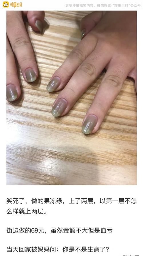 济南哪家看牛皮癣看的好 怀孕期间牛皮癣怎么办呢 济南哪家看牛皮癣看的好 怀孕期间牛皮癣怎么办呢