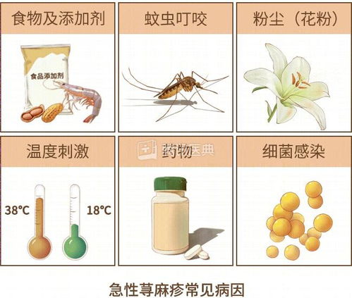 出现风团是荨麻疹的典型症状 出现风团是荨麻疹的典型症状