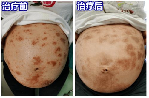 ���������� ����������