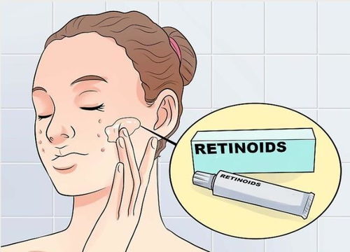 季节性湿疹饮食上需要哪些问题 季节性湿疹饮食上需要哪些问题