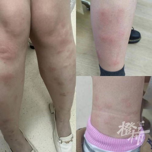 女人吃什么对肾好 女人吃什么对肾好