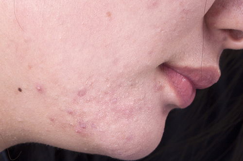 �빮������ �빮�汲