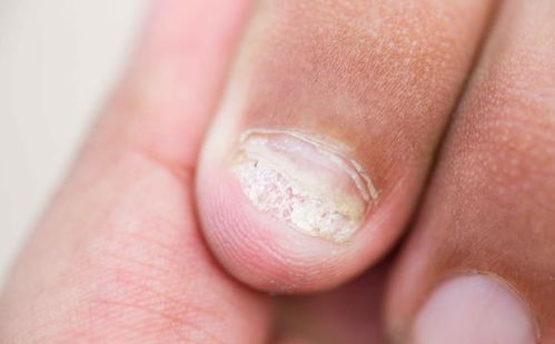 ��ô��Ч����ݡ����