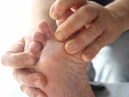 帅哥玩梗说狗子脸上长脚气结果一晚上23w赞 网友 帅照无人问 脚气天下知 帅哥玩梗说狗子脸上长脚气结果一晚上23w赞 网友 帅照无人问 脚气天下知