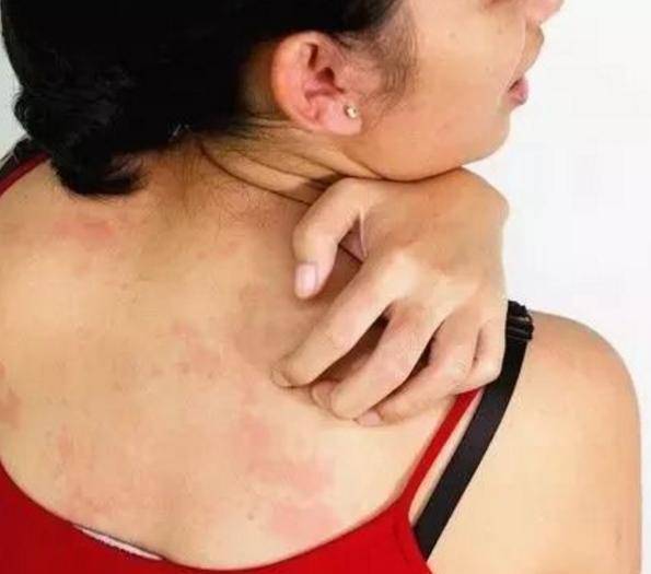 上火口腔溃疡牙龈肿痛怎么办 上火口腔溃疡牙龈肿痛怎么办