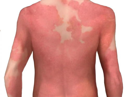 ѹ����ݡ�����֢״��ʲô