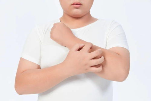 灰指甲的传染途径 灰指甲的传染途径