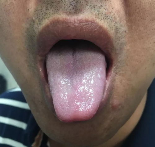 专业看脚气医院在那 专业看脚气医院在那