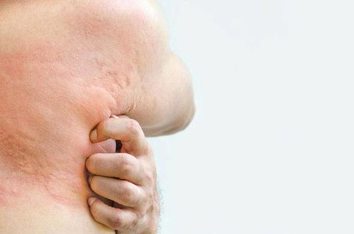 什么情况会造成低钾 什么情况会造成低钾