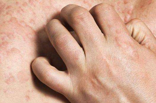 维c饭前吃还是饭后吃 维c饭前吃还是饭后吃