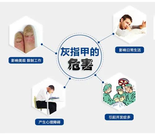 2岁小孩诺如病毒感染吃什么药 2岁小孩诺如病毒感染吃什么药