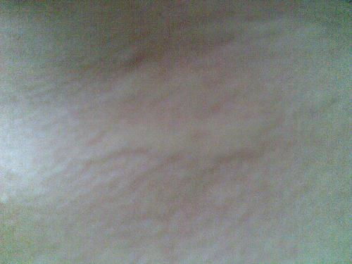 形成脚气是来自哪些病因 形成脚气是来自哪些病因