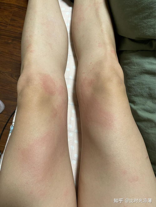 �����Ծ���������Ϊ������ݡ�����֢״