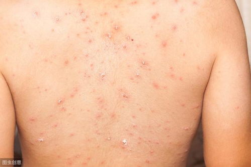 ݡ������ôҽ�� 