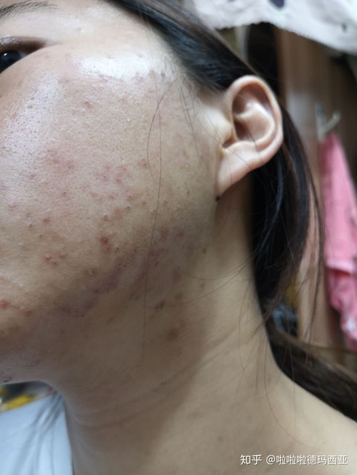 ��������Ƥ�����Ǽ�ҽԺ�ȽϺ� ������ݡ����ȥ���￴ 