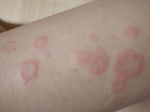 ʪ����ʳ��ʲô�ȽϺ�