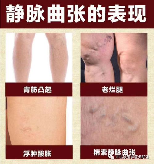 ����������ʪ��ʲô��˼