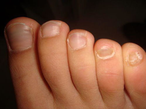 �и�ʪ���ʲôʳ��õÿ�