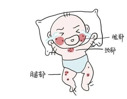 ʪ�����ʲô����