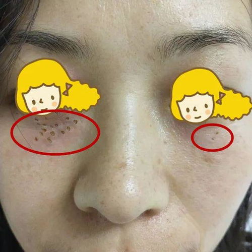 潮湿是脚气的温床 潮湿是脚气的温床