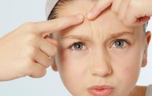 灰指甲的初期症状图 灰指甲的初期症状图