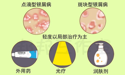 生活中怎么护理痤疮 生活中怎么护理痤疮