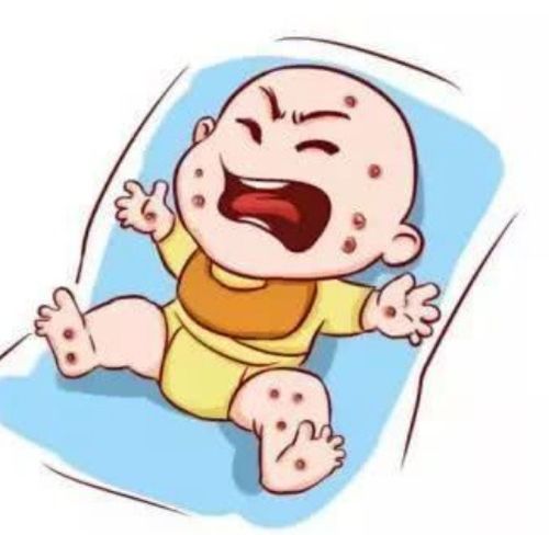 宝宝3个月就开始长湿疹到皮肤科开了尤卓尔和曲咪乳涂好了 宝宝3个月就开始长湿疹到皮肤科开了尤卓尔和曲咪乳涂好了