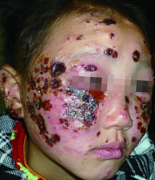 上吐下泻是什么原因引起的 上吐下泻是什么原因引起的