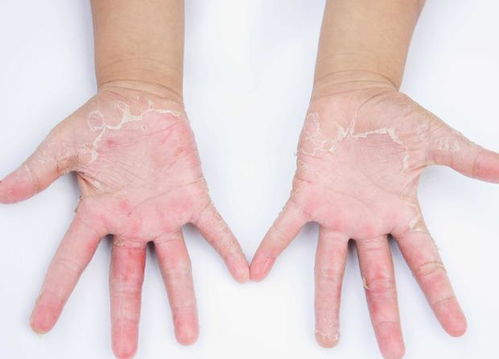 �鷿ʪ��������ڻ�ױƷ��������