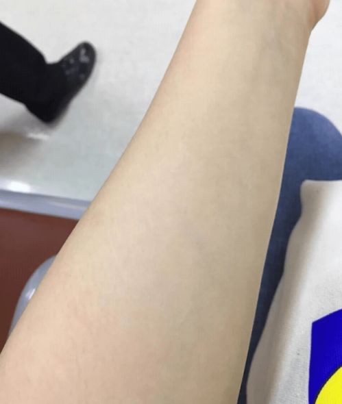 尿胆原是什么 尿胆原是什么