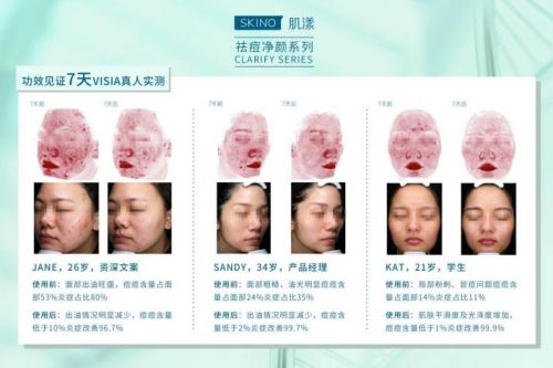 婴儿湿疹的原因及办法 婴儿湿疹的原因及办法