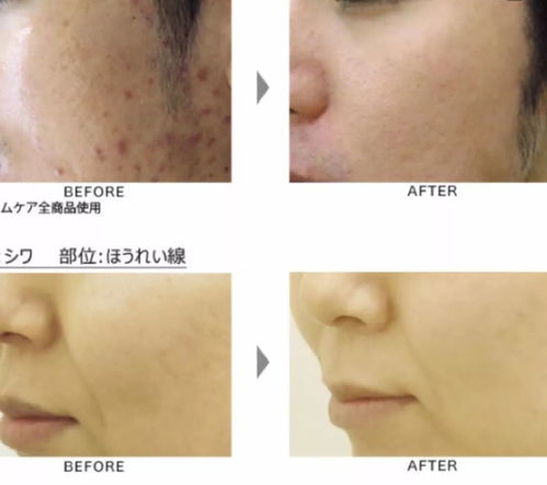 什么胃病会引起胸闷心慌 什么胃病会引起胸闷心慌