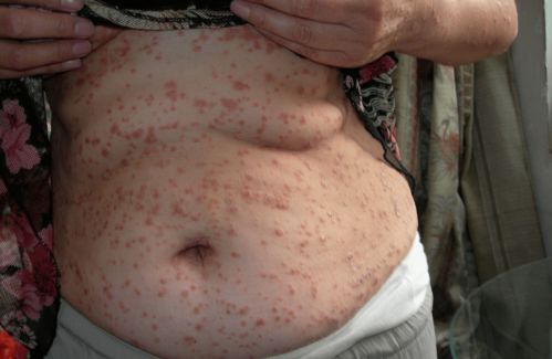 ��ʪ�����Ҫԭ����ʲô