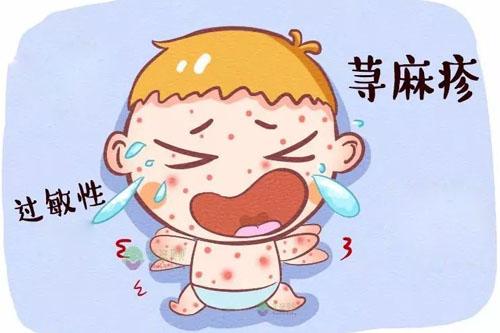 腮腺炎不能吃什么食物 腮腺炎不能吃什么食物