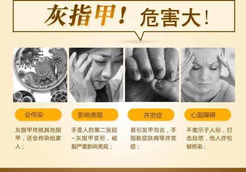 荨麻疹不好治吗 荨麻疹不好治吗