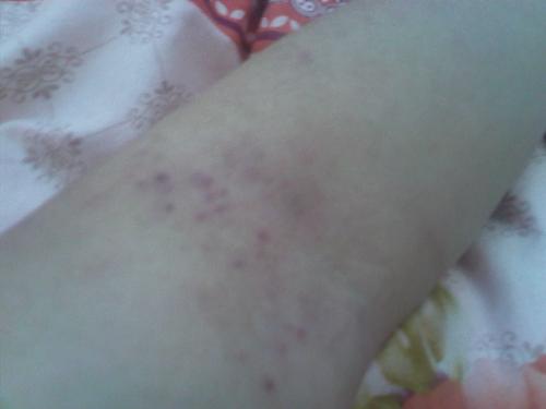 ����ʪ���ʲôʳ������õÿ�  ����Щ��ʳ���� 