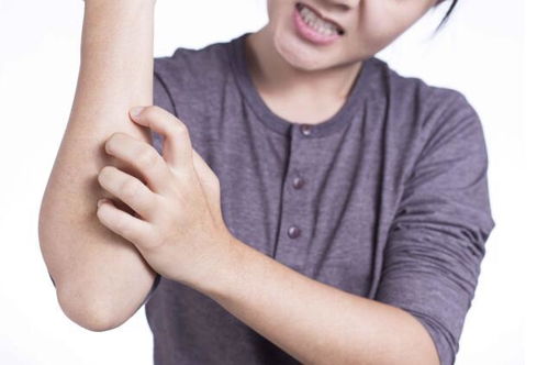 哪些习惯造成可能引来顽固湿疹呢 哪些习惯造成可能引来顽固湿疹呢