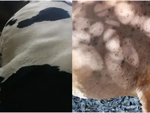 脸上的痘痘痤疮怎么治疗方法 脸上的痘痘痤疮怎么治疗方法