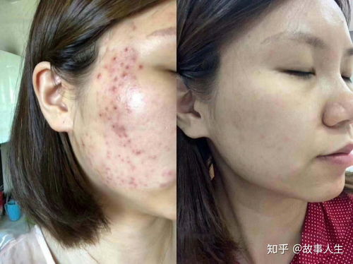 ����ʪ�������ԭ������Щ