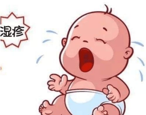 婴儿湿疹发病的原因是什么 婴儿湿疹发病的原因是什么