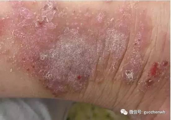 �ձ��������� �ձ�����������˵����