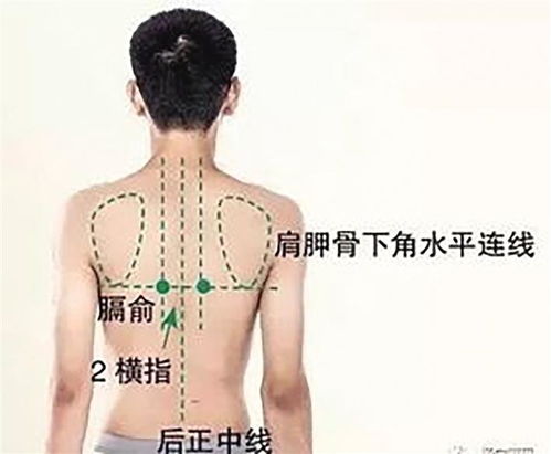 舌苔有裂纹吃什么药 舌苔有裂纹吃什么药