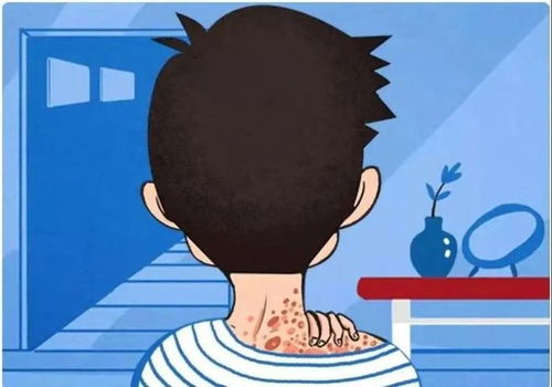 白酒泡什么药材治脚气 白酒泡什么药材治脚气