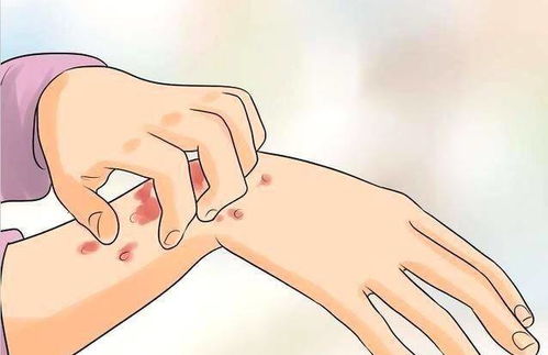 儿童患上灰指甲的症状 儿童患上灰指甲的症状