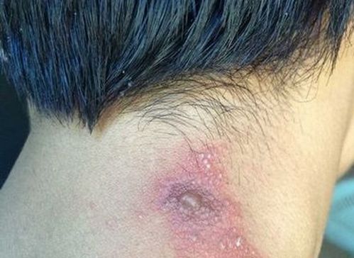 盐水泡脚有助于治脚气 盐水泡脚有助于治脚气