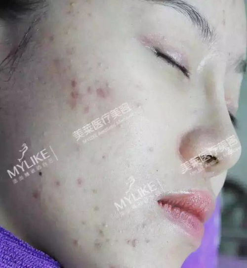 �ж����ֲ�ҩ���ν���