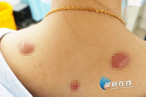 怎样用大蒜去除脚气味 怎样用大蒜去除脚气味