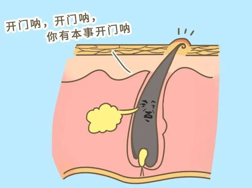 瓜子能去脚气 瓜子可以去除口臭吗 瓜子能去脚气 瓜子可以去除口臭吗